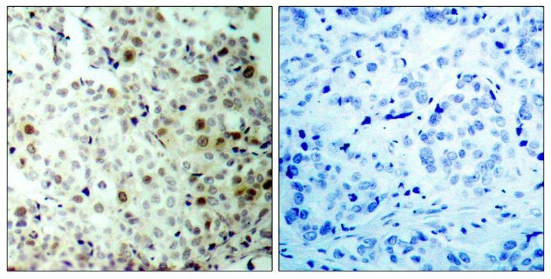 Anti-Phospho-CDK2 (Thr160) Polyclonal Antibody 2