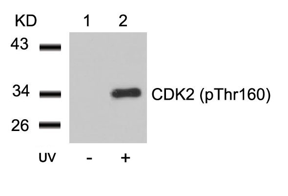 Anti-Phospho-CDK2 (Thr160) Polyclonal Antibody 2