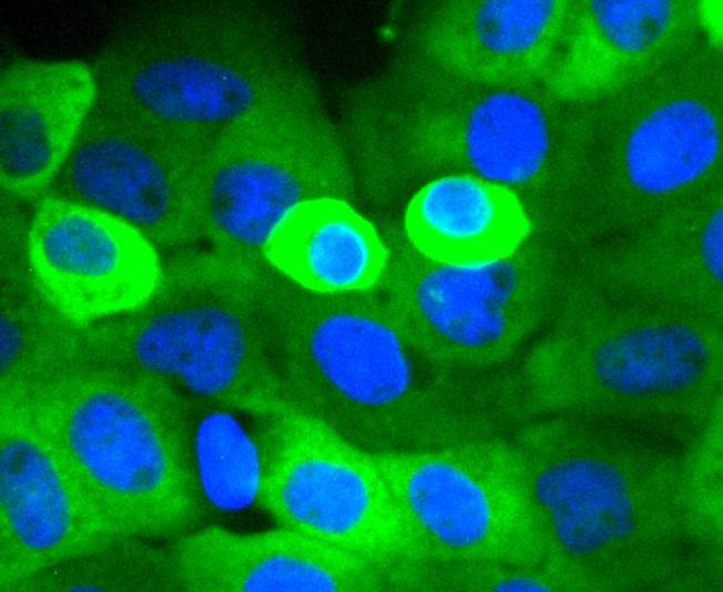 Anti-Cortactin Antibody (9I917)