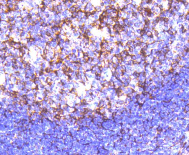 Anti-Cortactin Antibody (9I917)