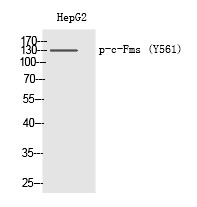 Anti-Phospho-CSF1R (Tyr561) Polyclonal Antibody 2