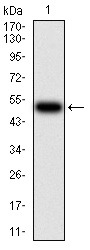 Anti-CFHR5 Antibody (9M883)