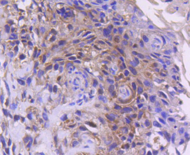 Anti-CDK4 Antibody (1F732)