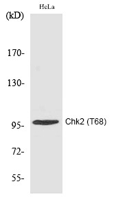 Anti-Phospho-CHEK2 (Thr68) Polyclonal Antibody
