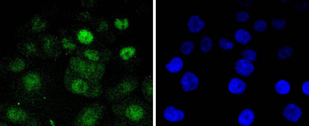 Anti-CDK4 Antibody (5A439)
