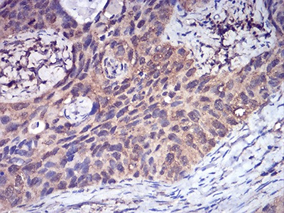 Anti-CFHR5 Antibody (9M883)
