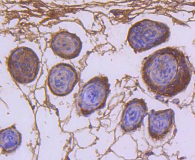 Anti-CDK1 Antibody (9C411)
