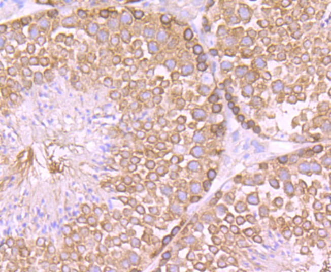 Anti-Cellular Apoptosis Susceptibility Antibody (8O505)