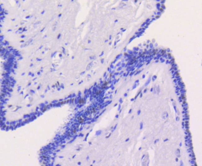 Anti-CHEK2 Antibody (3L509)