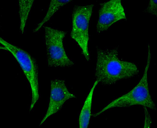 Anti-Cellular Apoptosis Susceptibility Antibody (8O505)