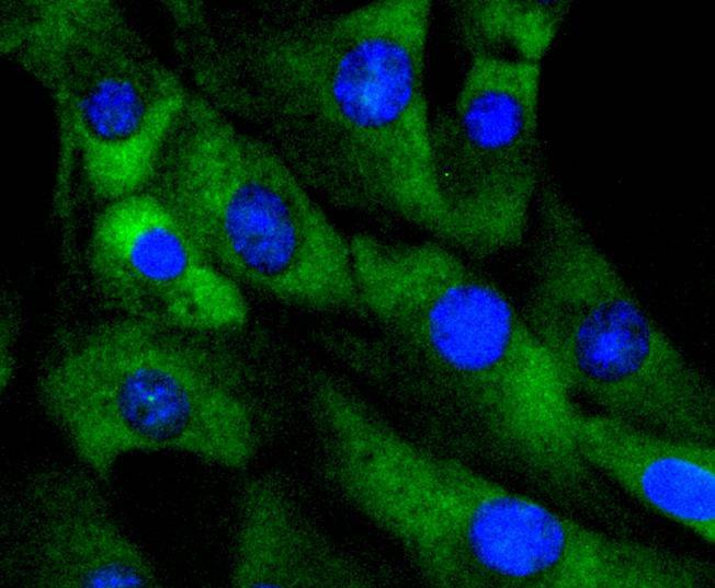Anti-CDK4 Antibody (1F732)