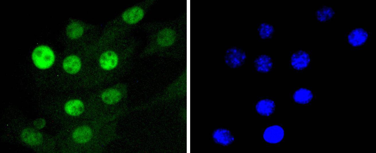 Anti-CDK4 Antibody (5A439)