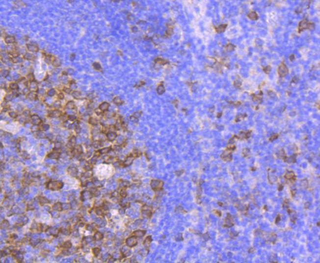 Anti-CDK1 Antibody (2M625)