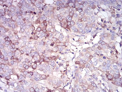 Anti-CDH11 Antibody (6T438)