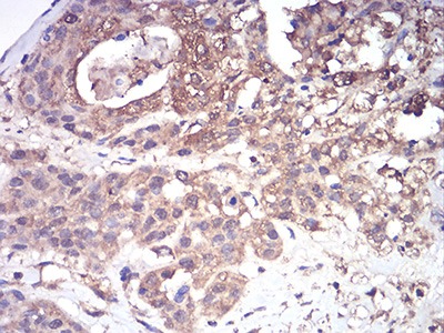 Anti-CFHR5 Antibody (9M883)
