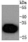 Anti-CDK4 Antibody (1F732)