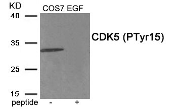 Anti-Phospho-CDK5 (Tyr15) Polyclonal Antibody