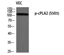 Anti-Phospho-PLA2G2A (Ser505) Polyclonal Antibody