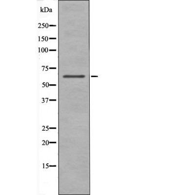Anti-Phospho-CHEK2 (Ser19) Polyclonal Antibody