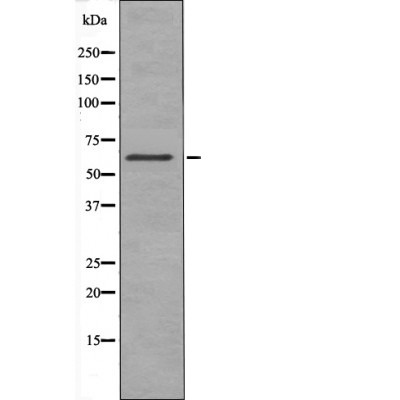Anti-Phospho-CHEK2 (Thr432) Polyclonal Antibody