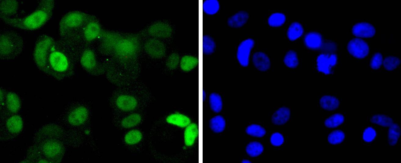 Anti-CDK4 Antibody (1F732)