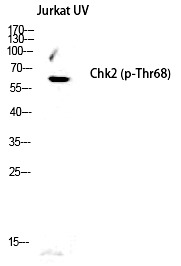 Anti-Phospho-CHEK2 (Thr68) Polyclonal Antibody