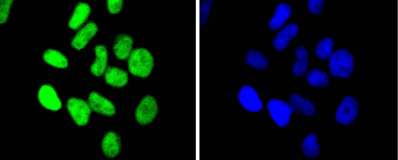 Anti-CHEK2 Antibody (3L509)