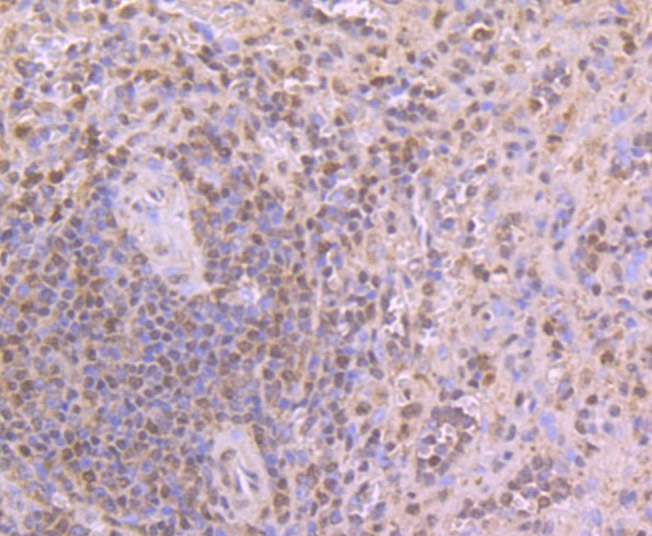Anti-CELF1 Antibody (3Z245)