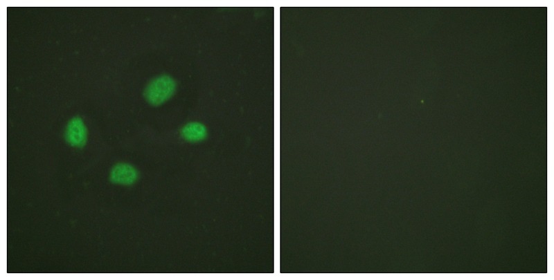Anti-Phospho-CHEK2 (Thr383) Polyclonal Antibody