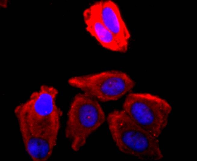 Anti-CDK1 Antibody (2M625)