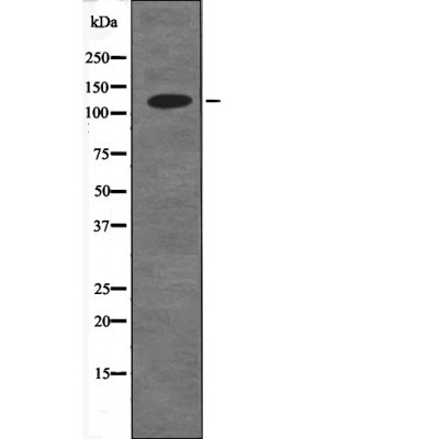Anti-Phospho-CDH1 (Ser844) Polyclonal Antibody