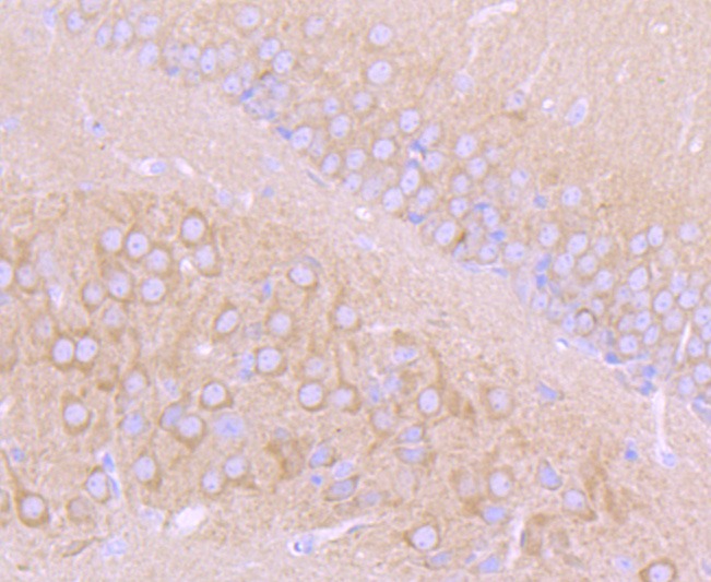 Anti-CHAT Antibody (3G910)