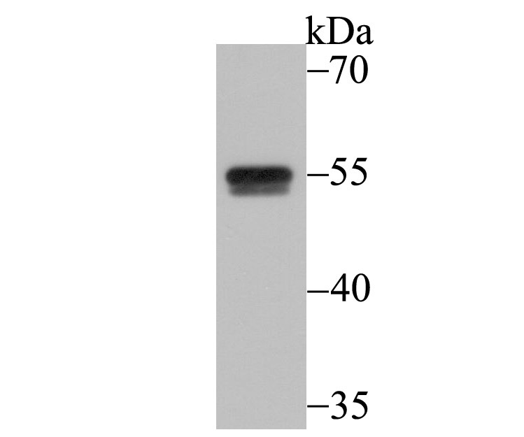 Anti-CELF1 Antibody (3Z245)