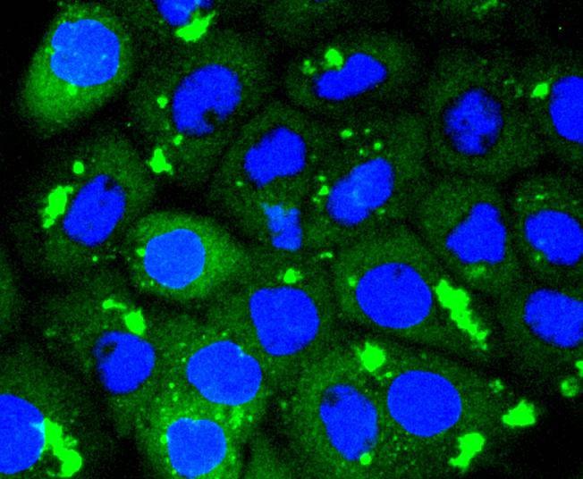 Anti-CDK1 Antibody (9C411)