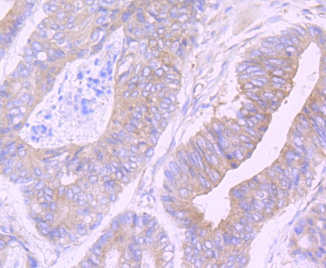 Anti-Cellular Apoptosis Susceptibility Antibody (8O505)