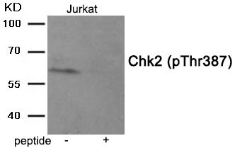 Anti-Phospho-CHEK2 (Thr387) Polyclonal Antibody