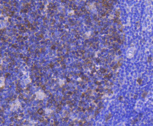 Anti-CDK1 Antibody (9C411)