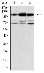 Anti-CDH11 Antibody (6T438)