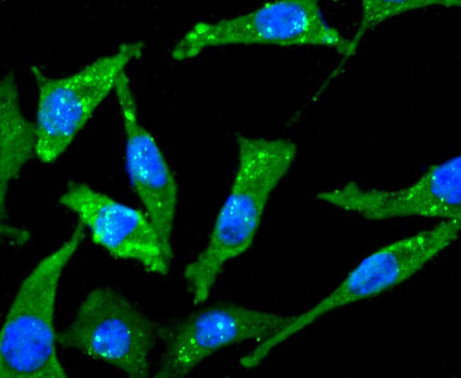 Anti-CHAT Antibody (3G910)
