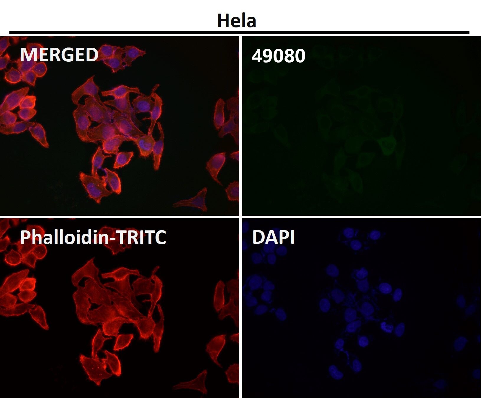 Anti-CCR2 Antibody (1X499)