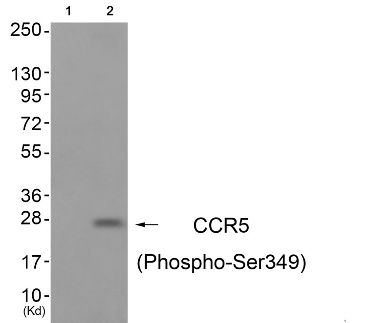 Anti-Phospho-CCR5 (Ser349) Polyclonal Antibody 2