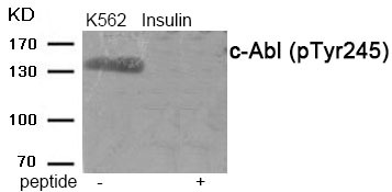 Anti-Phospho-C-ABL/ABL1 (Tyr245) Polyclonal Antibody