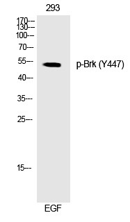 Anti-Phospho-Brk (Tyr447) Polyclonal Antibody