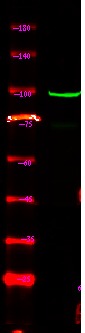 Anti-Phospho-BTK (Ser179) Polyclonal Antibody
