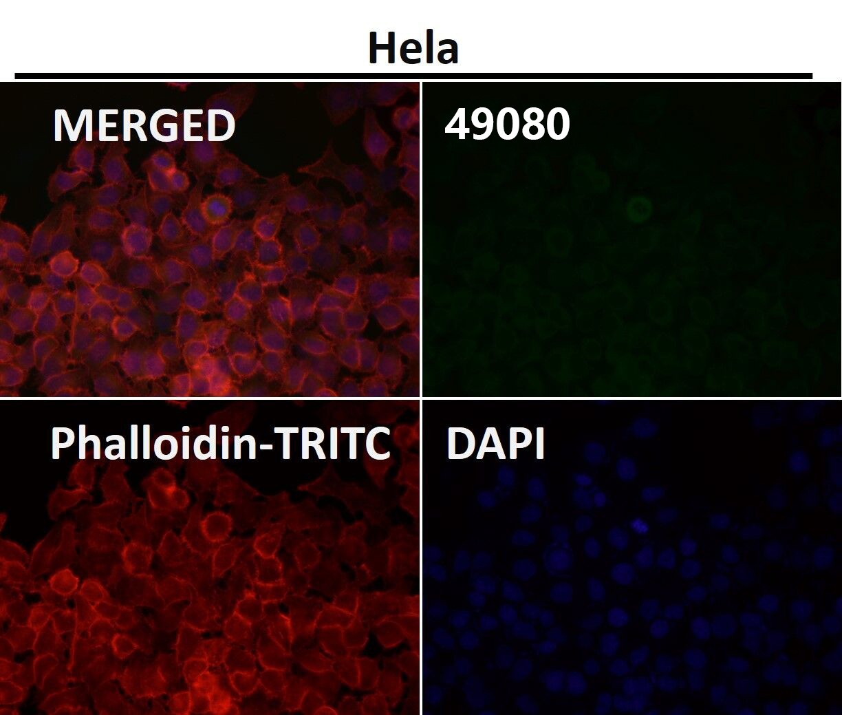 Anti-CCR2 Antibody (1X499)