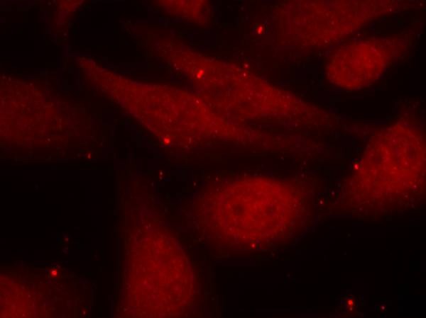 Anti-Phospho-C-ABL/ABL1 (Tyr412) Polyclonal Antibody