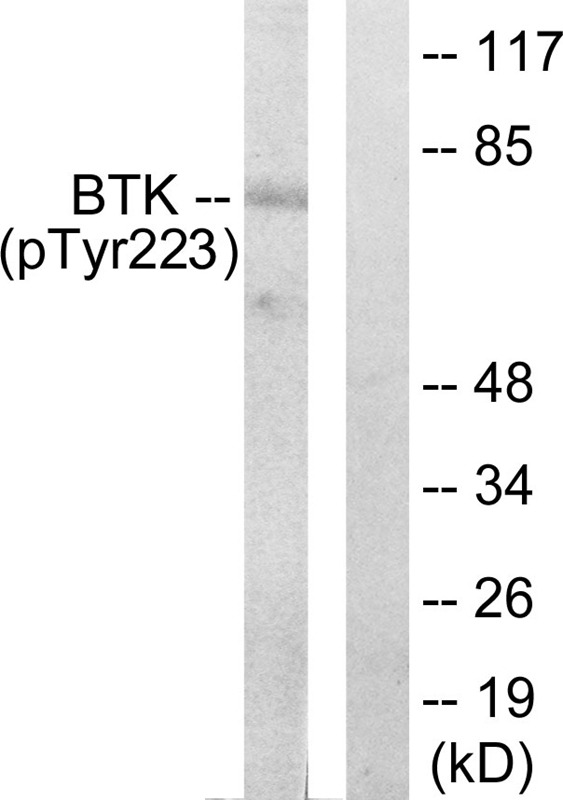Anti-Phospho-BTK (Tyr223) Polyclonal Antibody