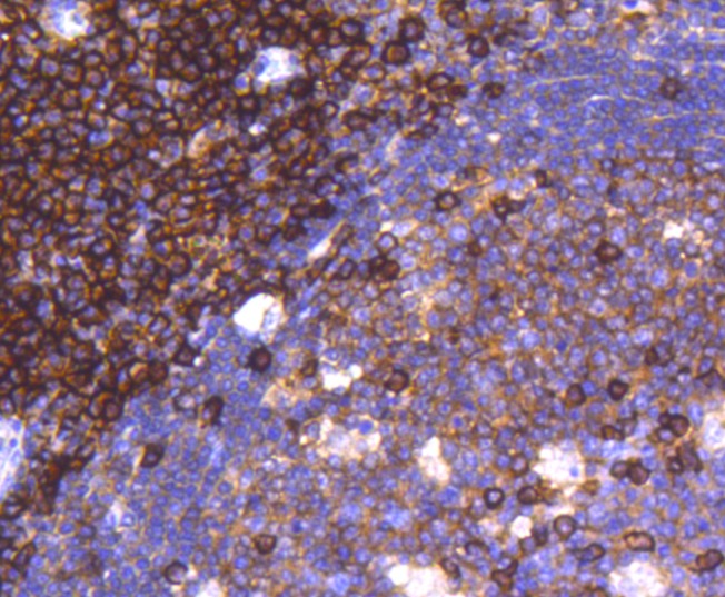 Anti-CD38 Antibody (4I413)