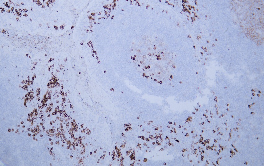 Anti-CD38 Antibody (1S733)