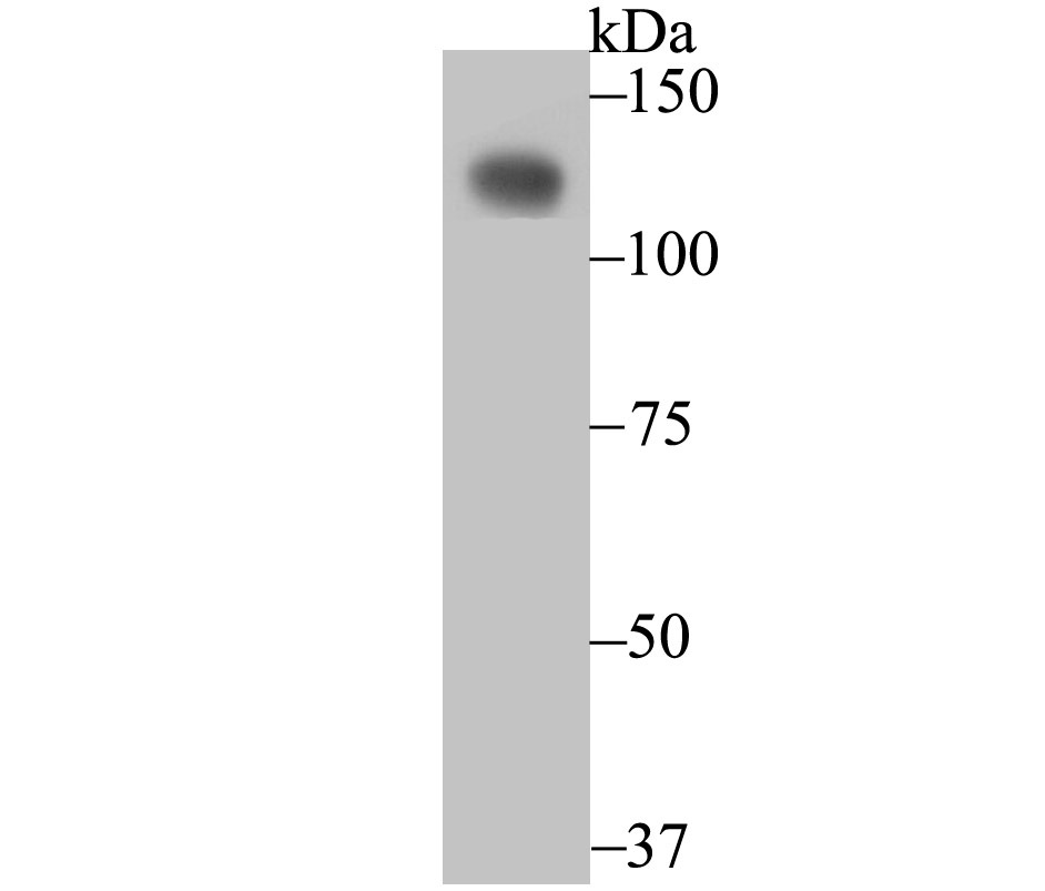 Anti-CD146/MCAM Antibody (6W862)
